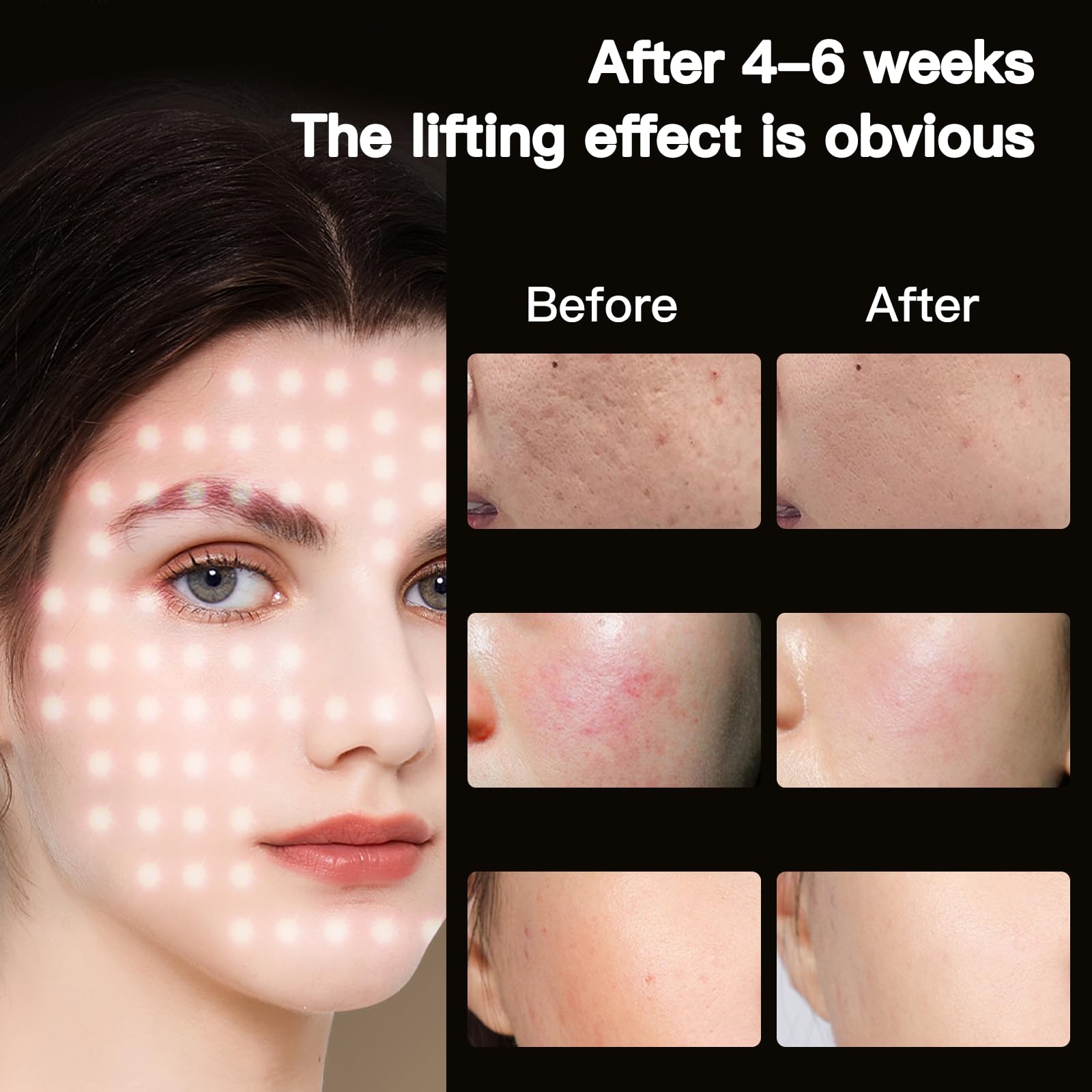 Bnlei Red Light Therapy for Face, LED Face Mask With Red, Yellow, Blue, etc. 7 colors Light Therapy Device Facial Mask